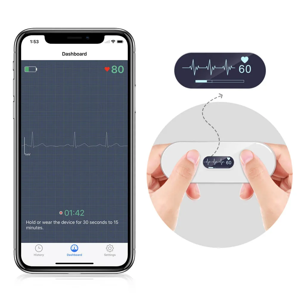 Portable ECG Monitor with OLED Screen